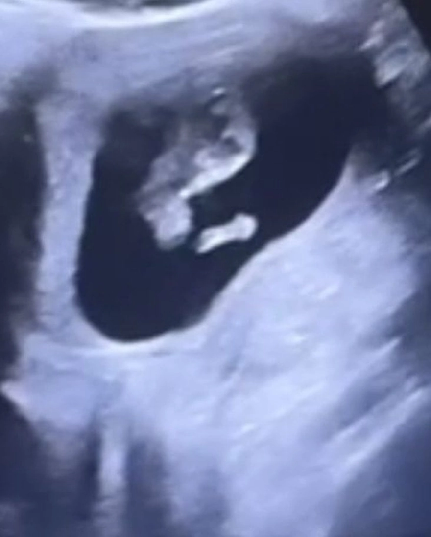 Beste Kökdemir, evlendiği gün bebek beklediği haberini paylaştı