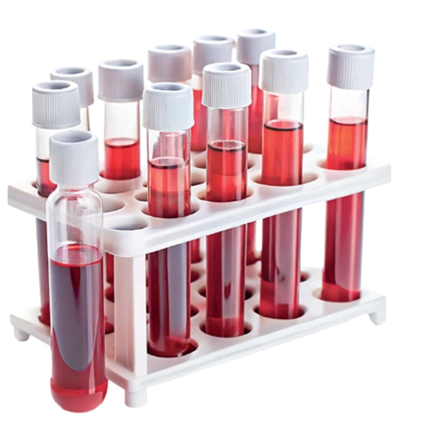 Kansızlık: Çocuk, Kadın ve Yaşlılarda Görülen Önemli Bir Sağlık Sorunu