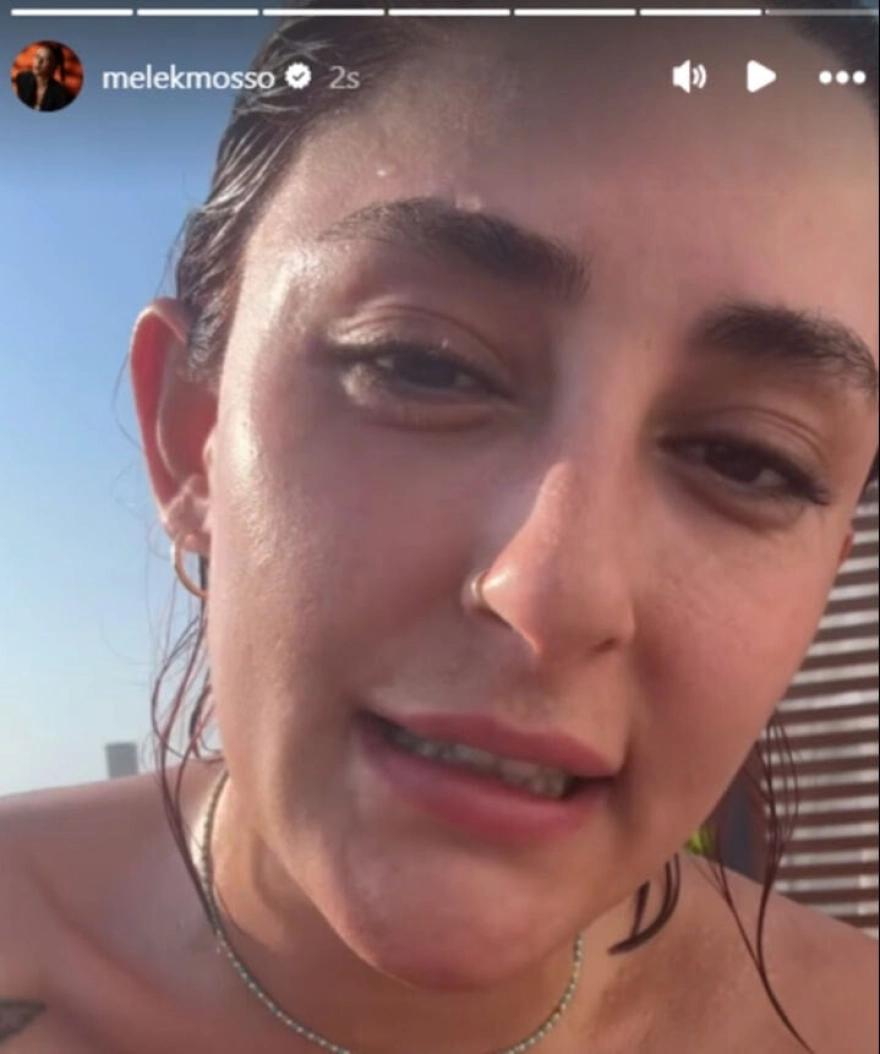 Şarkıcı Melek Mosso Kıbrıs tatilinde talihsiz bir kaza geçirdi