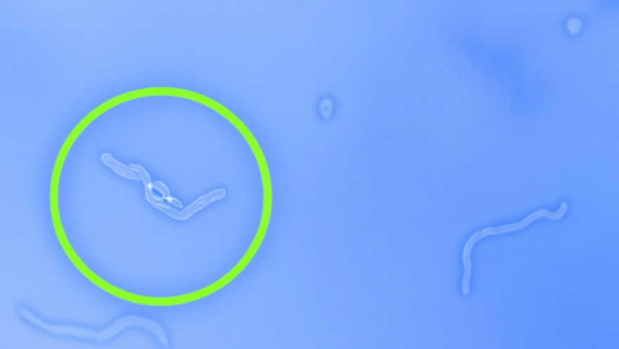 Gözlerinizde uçuşan cisimler gördüğünüz anda bu üç hareketi yapın