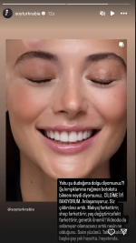 Genç oyuncu hakkındaki estetik iddialara sert tepki gösterdi: 'Siz çıldırdınız artık'